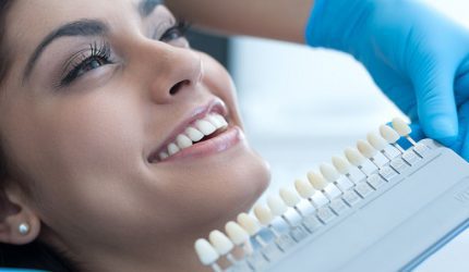 blanchiments des dents blanchiments des dents